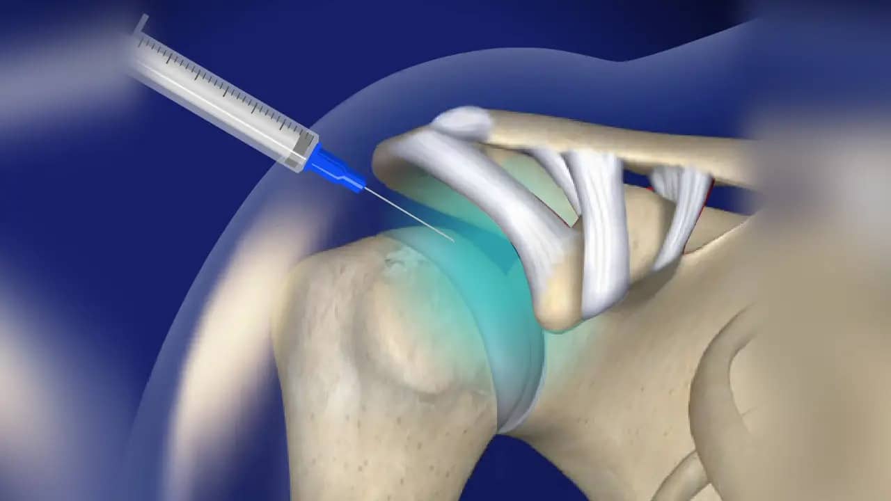 Pain Injection Downriver MI - Chronic Pain Treatment Wyandotte